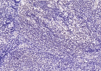 CDCA5 Rabbit Polyclonal Antibody