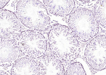 CDCA5 Rabbit Polyclonal Antibody