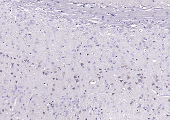 Beta arrestin 2 Rabbit Polyclonal Antibody