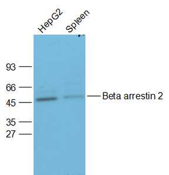 Beta arrestin 2 Rabbit Polyclonal Antibody