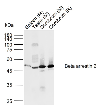 Beta arrestin 2 Rabbit Polyclonal Antibody