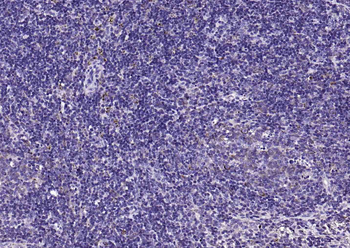 Beta arrestin 2 Rabbit Polyclonal Antibody