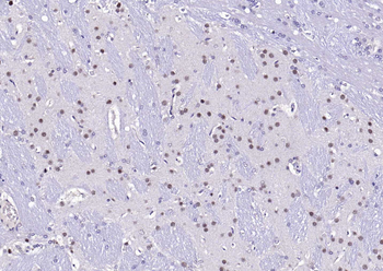 Beta arrestin 2 Rabbit Polyclonal Antibody