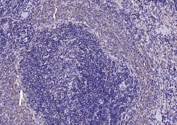 Beta arrestin 2 Rabbit Polyclonal Antibody