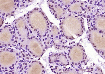 Beta arrestin 2 Rabbit Polyclonal Antibody