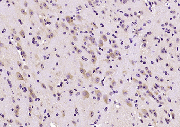 EB2 Rabbit Polyclonal Antibody