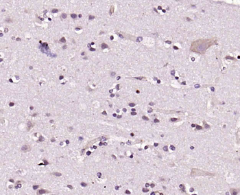 CLK2 Rabbit Polyclonal Antibody