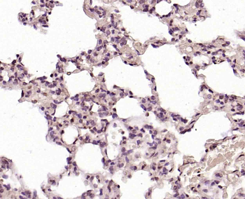 CLK2 Rabbit Polyclonal Antibody