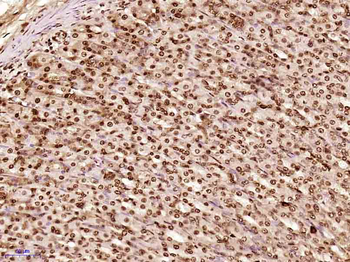 CLK2 Rabbit Polyclonal Antibody