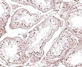 CLK2 Rabbit Polyclonal Antibody