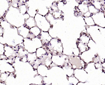 CLK2 Rabbit Polyclonal Antibody