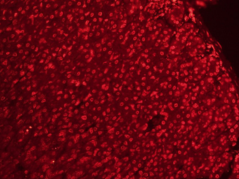 CLK2 Rabbit Polyclonal Antibody