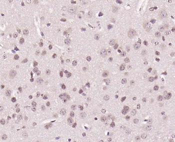CLK2 Rabbit Polyclonal Antibody