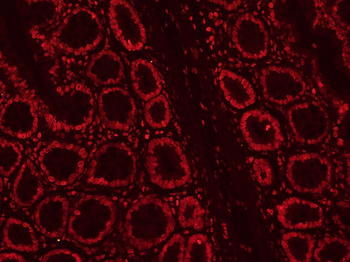 CLK2 Rabbit Polyclonal Antibody