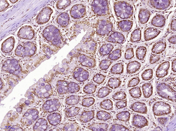 CLK2 Rabbit Polyclonal Antibody