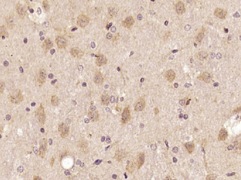 SIPA1L2 Rabbit Polyclonal Antibody