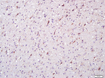 PAK1 Rabbit Polyclonal Antibody