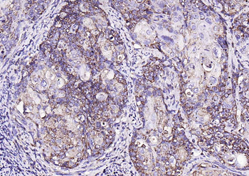 MMP-1 Rabbit Polyclonal Antibody