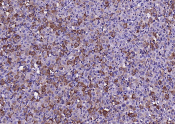 MMP-1 Rabbit Polyclonal Antibody