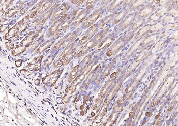MMP-1 Rabbit Polyclonal Antibody