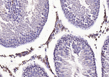 MMP-1 Rabbit Polyclonal Antibody