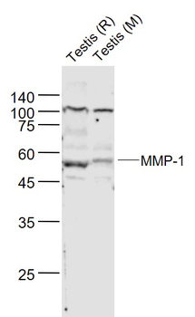 MMP-1 Rabbit Polyclonal Antibody
