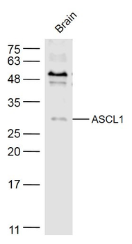 ASCL1 Rabbit Polyclonal Antibody