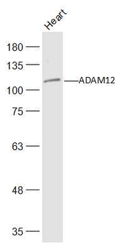 ADAM12 Rabbit Polyclonal Antibody