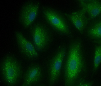 Ferritin Heavy Chain/FTH1 Rabbit Polyclonal Antibody