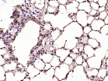 Ferritin Heavy Chain/FTH1 Rabbit Polyclonal Antibody