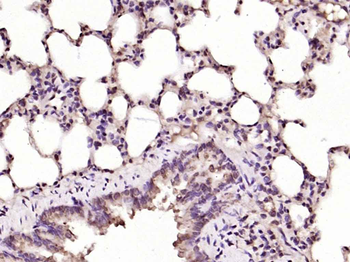 Ferritin Heavy Chain/FTH1 Rabbit Polyclonal Antibody