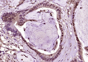 ANP32C Rabbit Polyclonal Antibody