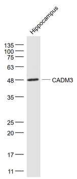 CADM3 Rabbit Polyclonal Antibody