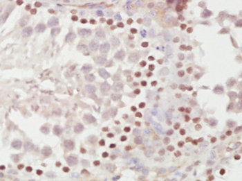 METTL11A Rabbit Polyclonal Antibody