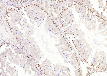 METTL11A Rabbit Polyclonal Antibody