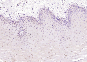 P73 Rabbit Polyclonal Antibody