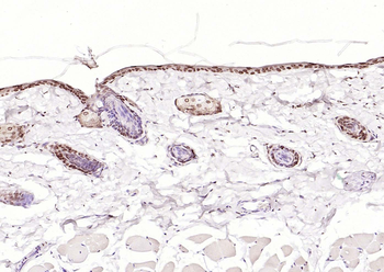 P73 Rabbit Polyclonal Antibody