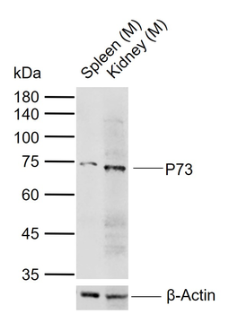 P73 Rabbit Polyclonal Antibody