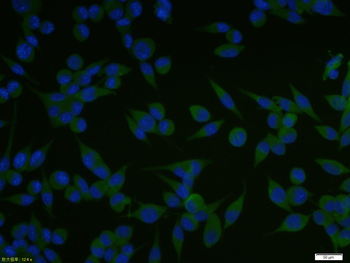 Vitamin D Receptor Rabbit Polyclonal Antibody
