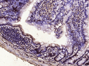 Vitamin D Receptor Rabbit Polyclonal Antibody