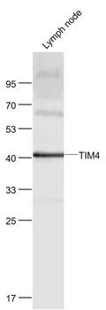 TIM4 Rabbit Polyclonal Antibody