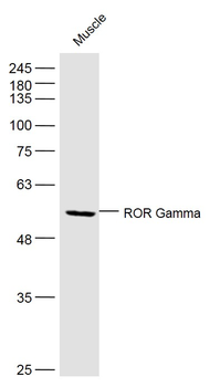 RORC Rabbit Polyclonal Antibody