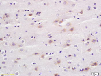 CACNB1 Rabbit Polyclonal Antibody