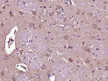 COG1 Rabbit Polyclonal Antibody