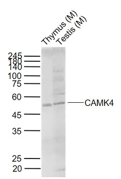CAMK4 Rabbit Polyclonal Antibody