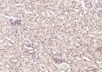 ATF2 Rabbit Polyclonal Antibody