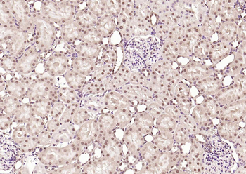 ATF2 Rabbit Polyclonal Antibody