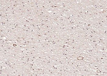 ATF2 Rabbit Polyclonal Antibody