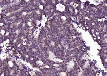 ATF2 Rabbit Polyclonal Antibody