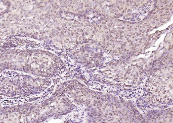 ATF2 Rabbit Polyclonal Antibody